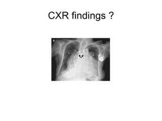 CXR findings ? 