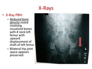 Clinical case - Lowe syndrome | PPTX