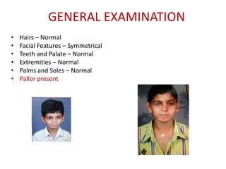 • Hairs – Normal
• Facial Features – Symmetrical
• Teeth and Palate – Normal
• Extremities – Normal
• Palms and Soles – Normal
• Pallor present
GENERAL EXAMINATION
 