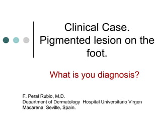 Clinical Case. Pigmented lesion on the foot. What is you diagnosis? F. Peral Rubio, M.D. Department of Dermatology  Hospital Universitario Virgen Macarena, Seville, Spain. 