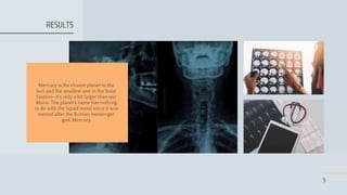 9
Mercury is the closest planet to the
Sun and the smallest one in the Solar
System—it’s only a bit larger than our
Moon. The planet’s name has nothing
to do with the liquid metal since it was
named after the Roman messenger
god, Mercury
RESULTS
 