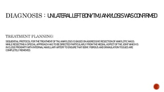 SEQUENTIAL PROTOCOL FOR THE TREATMENT OF TMJ ANKYLOSIS IS BASED ON AGGRESSIVE RESECTION OF ANKYLOTIC MASS.
WHILE RESECTING A SPECIAL APPROACH HAS TO BE DIRECTED PARTICULARLY FROM THE MEDIAL ASPECT OF THE JOINT WHICH IS
IN CLOSEPROXIMITY WITH INTERNAL MAXILLARY ARTERY TO ENSURE THAT BONY, FIBROUS AND GRANULATION TISSUES ARE
COMPLETELY REMOVED.
UNILATERALLEFTBONYTMJANKYLOSISWASCONFIRMED
 