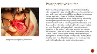Temporalis sling being harvested
Postoperative course
Active mouth opening exercises are started immediately
after postoperative pain subsides. However, for patients who
have undergone International Monetary Fund, exercises are
started soon after release of fixation. Patients are
encouraged to start gentle, active and gradually increasing
mouth opening exercises using their own fingers as a
monitor to start with, in order to gain self-confidence, and
they are allowed to take a soft diet. Wooden tongue blades
are used thereafter with a gradually increasing number
according to the patient's tolerance, avoiding any passive
force or pain. This is performed under strict supervision for
15 min 5 times a day. Regular weekly visits are arranged
during the 1st month, biweekly for the next 3 months, then
monthly for 1 year .The child regained her beaming smile
and relishing her favorite foods with enthusiasm.
 