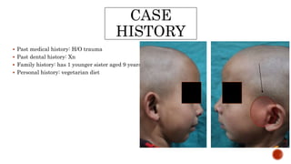 CASE
HISTORY
 Past medical history: H/O trauma
 Past dental history: Xn
 Family history: has 1 younger sister aged 9 years
 Personal history: vegetarian diet
 
