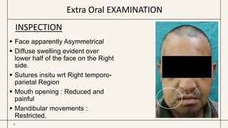 Extra Oral EXAMINATION
4
 Face apparently Asymmetrical
 Diffuse swelling evident over
lower half of the face on the Right
side.
 Sutures insitu wrt Right temporo-
parietal Region
 Mouth opening : Reduced and
painful
 Mandibular movements :
Restricted.
INSPECTION
 