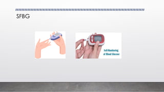 SFBG
 