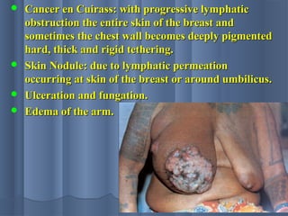  Cancer en Cuirass: with progressive lymphaticCancer en Cuirass: with progressive lymphatic
obstruction the entire skin of the breast andobstruction the entire skin of the breast and
sometimes the chest wall becomes deeply pigmentedsometimes the chest wall becomes deeply pigmented
hard, thick and rigid tethering.hard, thick and rigid tethering.
 Skin Nodule: due to lymphatic permeationSkin Nodule: due to lymphatic permeation
occurring at skin of the breast or around umbilicus.occurring at skin of the breast or around umbilicus.
 Ulceration and fungation.Ulceration and fungation.
 Edema of the arm.Edema of the arm.
 