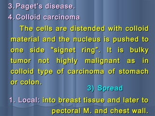 3.3. Paget’s disease.Paget’s disease.
The cells are distended with colloidThe cells are distended with colloid
material and the nucleus is pushed tomaterial and the nucleus is pushed to
one side "signet ring”. It is bulkyone side "signet ring”. It is bulky
tumor not highly malignant as intumor not highly malignant as in
colloid type of carcinoma of stomachcolloid type of carcinoma of stomach
or colon.or colon.
4.4. Colloid carcinomaColloid carcinoma
1. Local:1. Local: into breast tissue and later tointo breast tissue and later to
pectoral M. and chest wall.pectoral M. and chest wall.
3)3) SpreadSpread
 