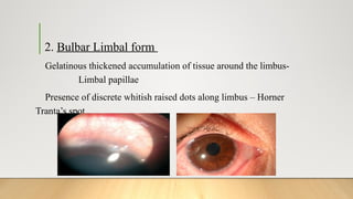 Limbus Tissue CLINICAL CASE PRESENTATION final on details | PPTX