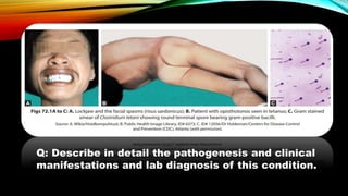 Q: Describe in detail the pathogenesis and clinical
manifestations and lab diagnosis of this condition.
 