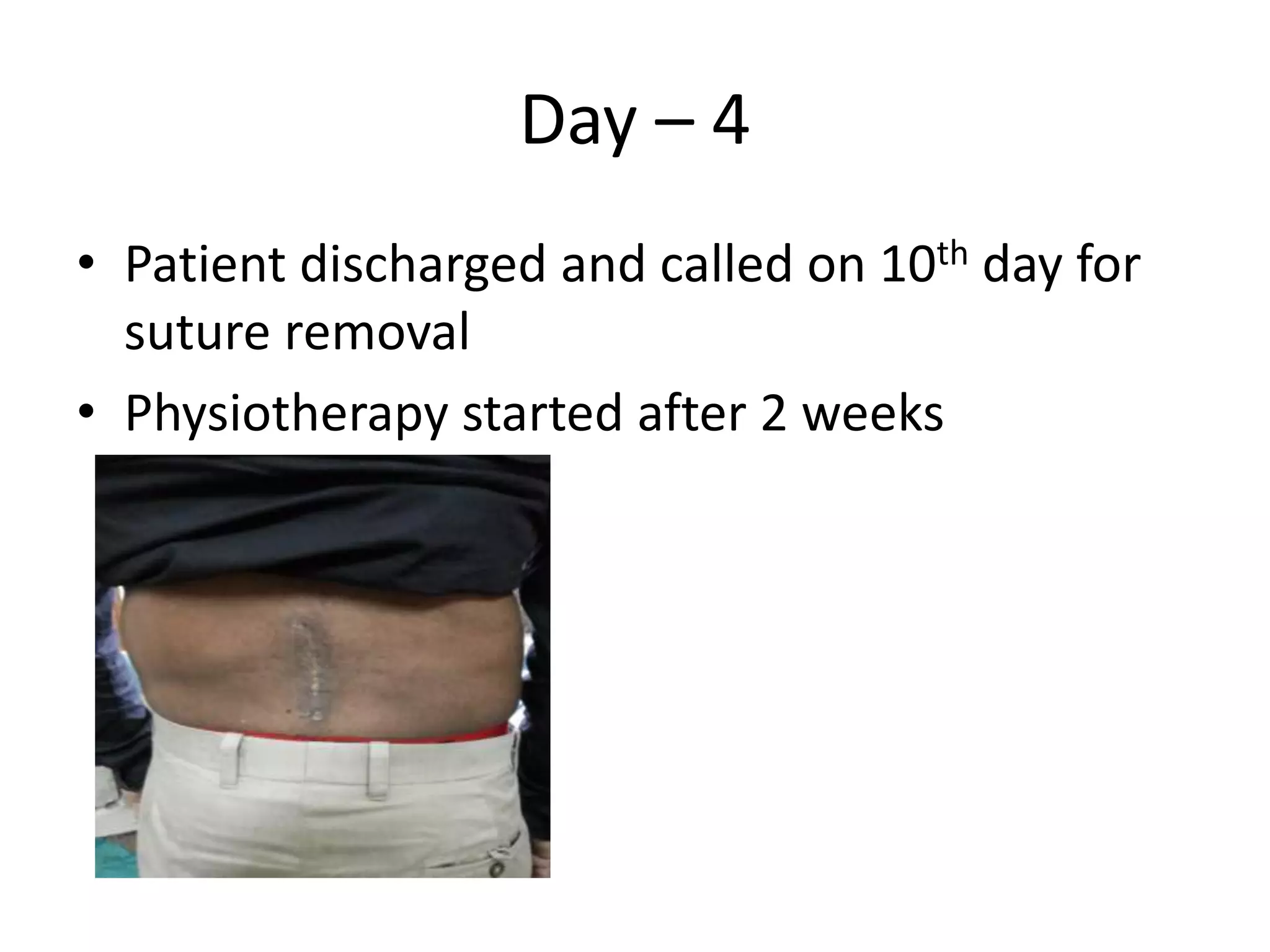 Day – 4
• Patient discharged and called on 10th day for
suture removal
• Physiotherapy started after 2 weeks
 