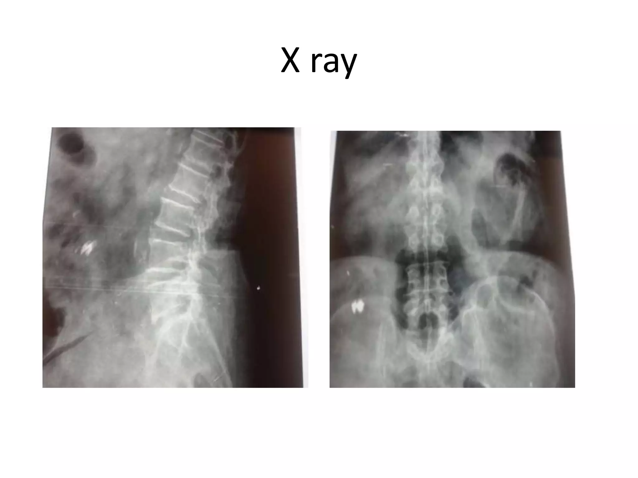 X ray
 