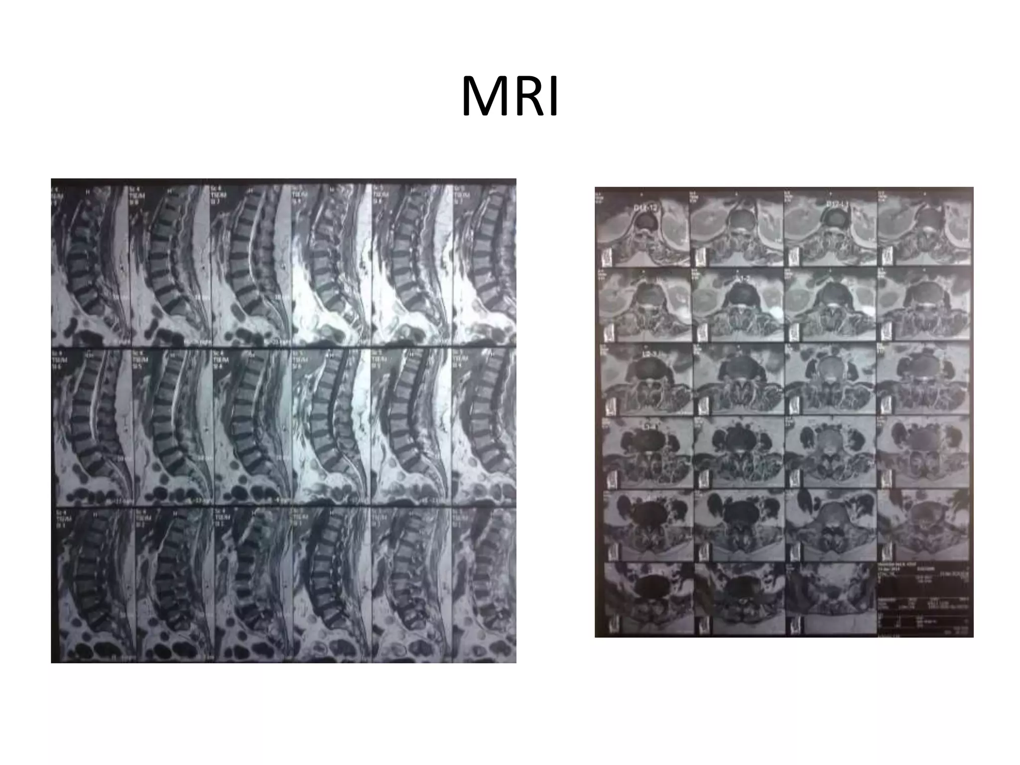 MRI
 