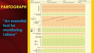 Clinical cases of normal labour - By Sara Khalid Memon | PPTX