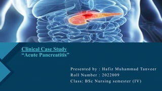 Click to edit Master title style
1
Clinical Case Study
“Acute Pancreatitis”
Presented by : Hafiz Muhammad Tanveer
Roll Number : 2022009
Class: BSc Nursing semester (IV)
 