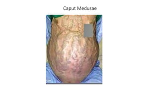 Caput Med Clinical Charts of Limbs, Thorax, Abdomen & Head & neck pptx | PPTX