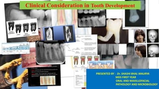 Clinical Consideration in Tooth Development
PRESENTED BY : Dr. SHASHI BHAL MAURYA
MDS FIRST YEAR
ORAL AND MAXILLOFACIAL
PATHOLOGY AND MICROBIOLOGY
 