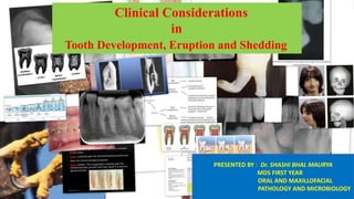 Clinical Considerations
in
Tooth Development, Eruption and Shedding
PRESENTED BY : Dr. SHASHI BHAL MAURYA
MDS FIRST YEAR
ORAL AND MAXILLOFACIAL
PATHOLOGY AND MICROBIOLOGY
 