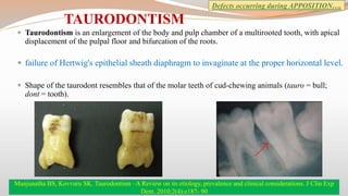 Bull Tooth Clinical consideration in tooth development, eruption and shedding | PPTX