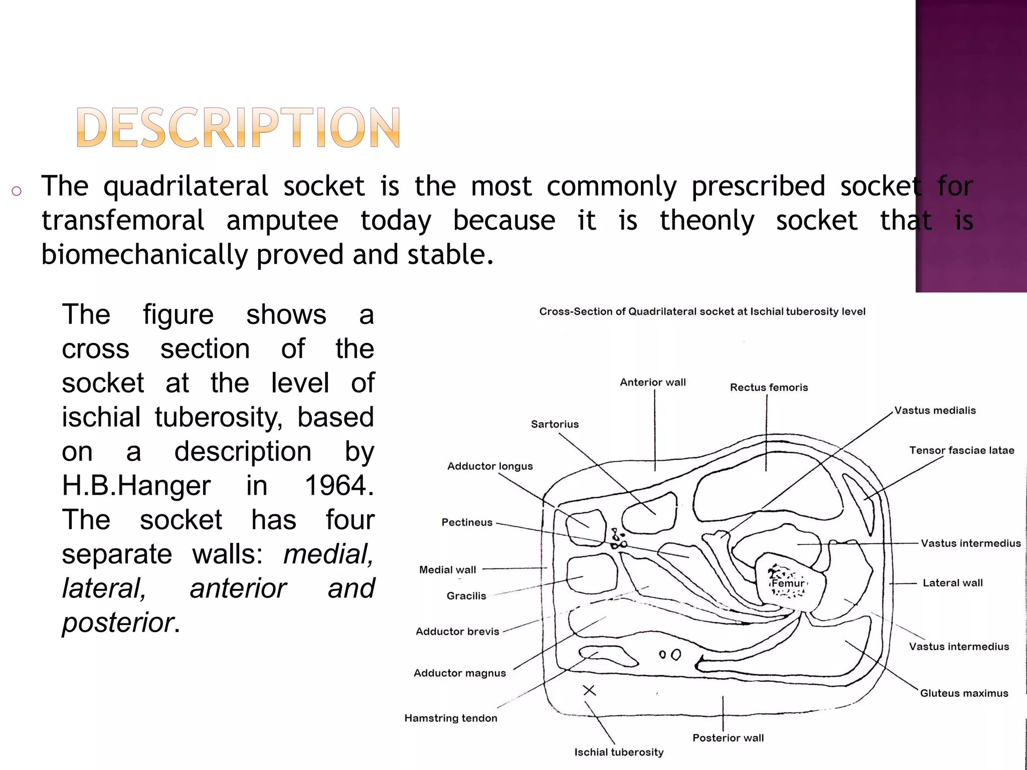 o The quadrilateral socket is the most commonly prescribed socket for
transfemoral amputee today because it is theonly socket that is
biomechanically proved and stable.
The figure shows a
cross section of the
socket at the level of
ischial tuberosity, based
on a description by
H.B.Hanger in 1964.
The socket has four
separate walls: medial,
lateral, anterior and
posterior.
 
