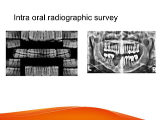 Intra oral radiographic survey
 