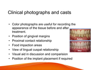 Clinical photographs and casts
• Color photographs are useful for recording the
appearance of the tissue before and after
treatment.
• Position of gingival margins
• Proximal contact relationship
• Food impaction areas
• View of lingual cuspal relationship
• Visual aid in discussion and comparision
• Position of the implant placement if required
 