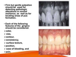 • Firm but gentle palpation
should be used for
detecting pathologic
alterations in normal
resilience, as well as for
locating areas of pus
formation.
• Each of the following
features of the gingiva
should be considered:
color,
 size,
contour,
consistency,
 surface texture,
position,
 ease of bleeding, and
pain.
 