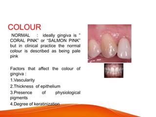 COLOUR
NORMAL : ideally gingiva is ”
CORAL PINK” or “SALMON PINK”
but in clinical practice the normal
colour is described as being pale
pink
Factors that affect the colour of
gingiva :
1.Vascularity
2.Thickness of epithelium
3.Presence of physiological
pigments
4.Degree of keratinization
 