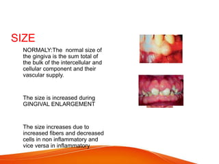 SIZE
 NORMALY:The normal size of
the gingiva is the sum total of
the bulk of the intercellular and
cellular component and their
vascular supply.
 The size is increased during
GINGIVAL ENLARGEMENT
 The size increases due to
increased fibers and decreased
cells in non inflammatory and
vice versa in inflammatory
 