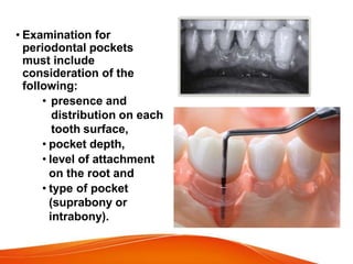 • Examination for
periodontal pockets
must include
consideration of the
following:
• presence and
distribution on each
tooth surface,
• pocket depth,
• level of attachment
on the root and
• type of pocket
(suprabony or
intrabony).
 