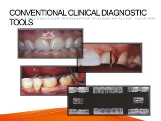CONVENTIONALCLINICALDIAGNOSTIC
TOOLS
 