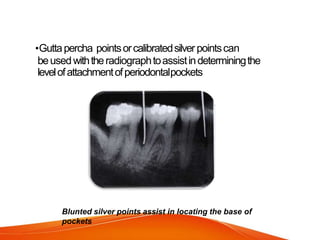 •Guttapercha pointsorcalibratedsilver pointscan
beusedwiththeradiographtoassistindeterminingthe
levelofattachmentofperiodontalpockets
Blunted silver points assist in locating the base of
pockets
 