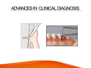 ADVANCESIN CLINICALDIAGNOSIS
 