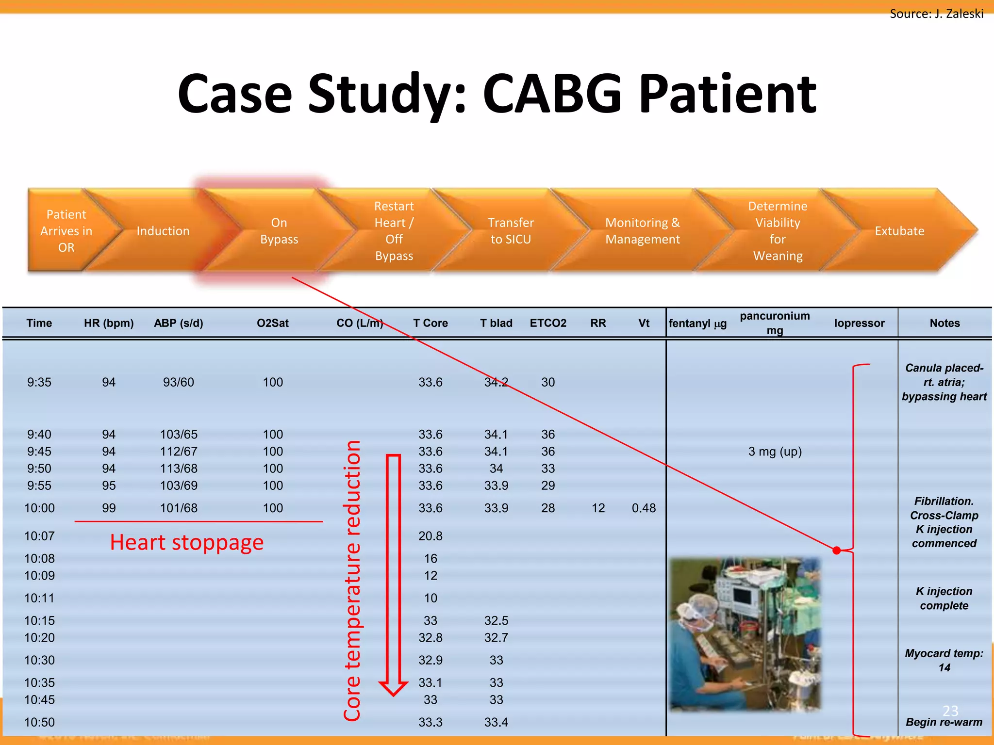 Source: J. Zaleski




                             Case Study: CABG Patient
                                                                           Restart                                                     Determine
     Patient
                                       On                                  Heart /           Transfer         Monitoring &              Viability
    Arrives in         Induction                                                                                                                           Extubate
                                     Bypass                                  Off             to SICU          Management                   for
       OR
                                                                           Bypass                                                       Weaning



                                                                                                                                      pancuronium
  Time      HR (bpm)     ABP (s/d)   O2Sat    CO (L/m)                           T Core     T blad   ETCO2   RR    Vt    fentanyl g                 lopressor          Notes
                                                                                                                                          mg


                                                                                                                                                                  Canula placed-
  9:35           94        93/60     100                                             33.6   34.2        30                                                           rt. atria;
                                                                                                                                                                  bypassing heart


  9:40           94       103/65     100                                             33.6   34.1        36
                                              Core temperature reduction


  9:45           94       112/67     100                                             33.6   34.1        36                             3 mg (up)
  9:50           94       113/68     100                                             33.6    34         33
  9:55           95       103/69     100                                             33.6   33.9        29
                                                                                                                                                                    Fibrillation.
 10:00           99       101/68     100                                             33.6   33.9        28   12   0.48
                                                                                                                                                                   Cross-Clamp
                                                                                                                                                                    K injection
 10:07
                  Heart stoppage                                                     20.8
                                                                                                                                                                   commenced
 10:08                                                                               16
 10:09                                                                               12
                                                                                                                                                                    K injection
 10:11                                                                               10
                                                                                                                                                                     complete
 10:15                                                                                33    32.5
 10:20                                                                               32.8   32.7
                                                                                                                                                                  Myocard temp:
 10:30                                                                               32.9    33
                                                                                                                                                                       14
 10:35                                                                               33.1    33
 10:45                                                                                33     33
                                                                                                                                                                          23
Sunday, May 29, 2011
  10:50                                                                              33.3   33.4                                                                  Begin re-warm
 