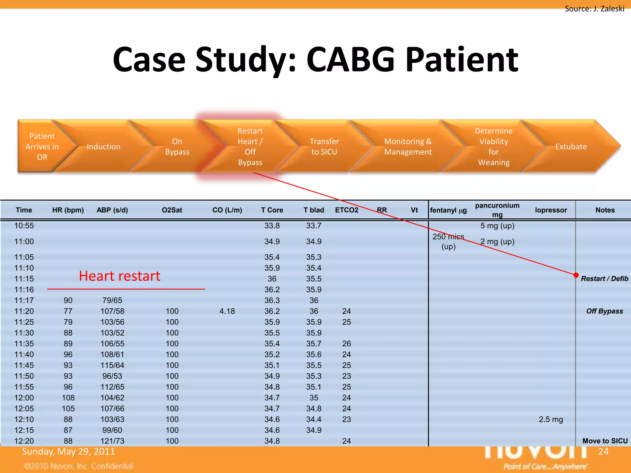 Source: J. Zaleski




                            Case Study: CABG Patient
                                                      Restart                                                      Determine
   Patient
                                       On             Heart /           Transfer         Monitoring &               Viability
  Arrives in          Induction                                                                                                       Extubate
                                     Bypass             Off             to SICU          Management                    for
     OR
                                                      Bypass                                                        Weaning



                                                                                                                   pancuronium
Time      HR (bpm)      ABP (s/d)    O2Sat    CO (L/m)      T Core     T blad   ETCO2   RR     Vt   fentanyl g                   lopressor          Notes
                                                                                                                       mg
10:55                                                           33.8   33.7                                         5 mg (up)
                                                                                                        250 mics
11:00                                                           34.9   34.9                                         2 mg (up)
                                                                                                          (up)
11:05                                                           35.4   35.3
11:10                                                           35.9   35.4
11:15                Heart restart                               36    35.5                                                                    Restart / Defib
11:16                                                           36.2   35.9
11:17          90         79/65                                 36.3    36
11:20          77        107/58      100       4.18             36.2    36         24                                                            Off Bypass
11:25          79        103/56      100                        35.9   35.9        25
11:30          88        103/52      100                        35.5   35.9
11:35          89        106/55      100                        35.4   35.7        26
11:40          96        108/61      100                        35.2   35.6        24
11:45          93        115/64      100                        35.1   35.5        25
11:50          93         96/53      100                        34.9   35.3        23
11:55          96        112/65      100                        34.8   35.1        25
12:00          108       104/62      100                        34.7    35         24
12:05          105       107/66      100                        34.7   34.8        24
12:10          88        103/63      100                        34.6   34.4        23                                             2.5 mg
12:15          87         99/60      100                        34.6   34.9
12:20          88        121/73      100                        34.8               24                                                           Move to SICU
  Sunday, May 29, 2011                                                                                                                               24
 