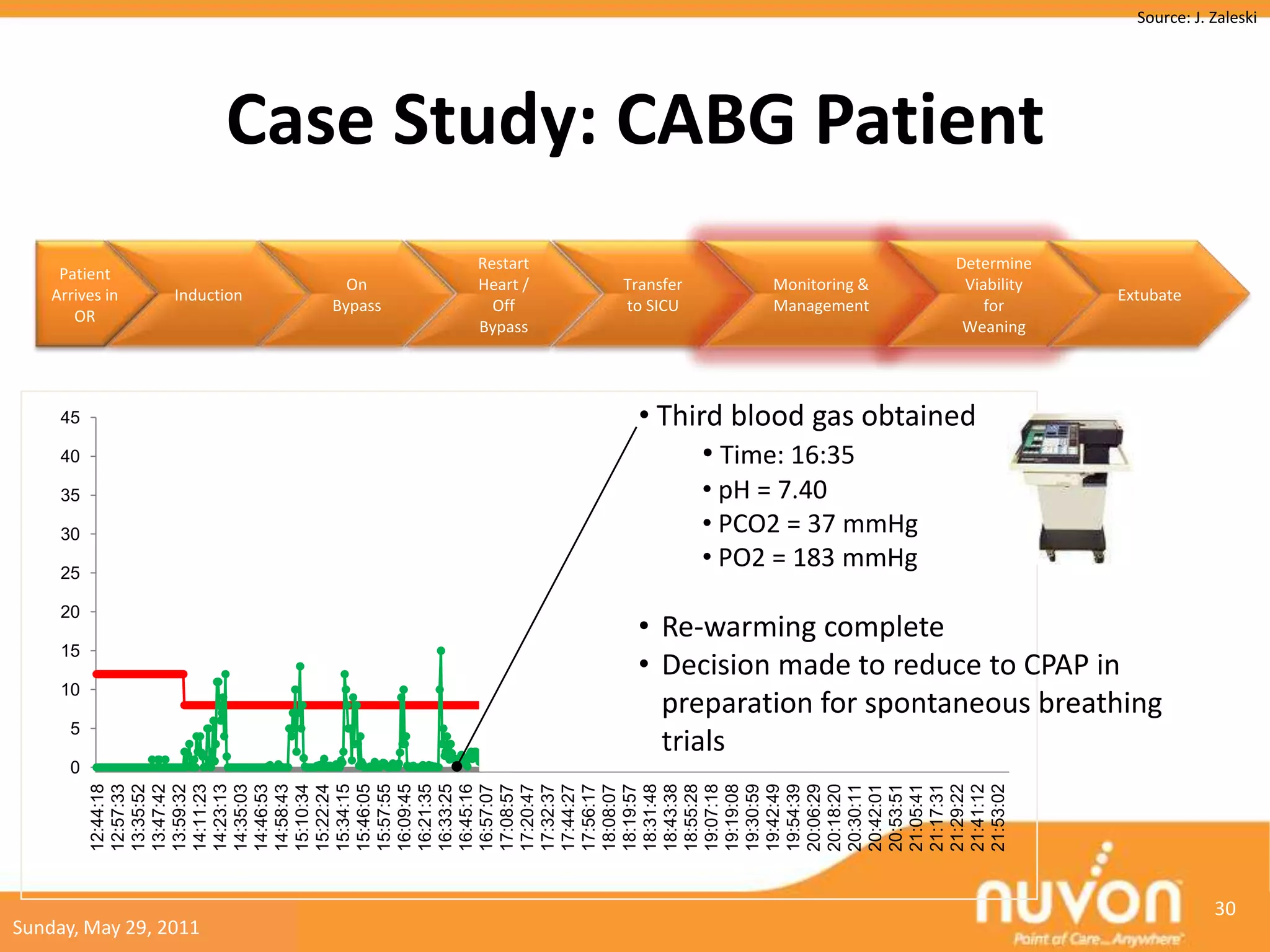 Source: J. Zaleski




                          Case Study: CABG Patient
                                       Restart                                  Determine
     Patient
                                On     Heart /   Transfer        Monitoring &    Viability
    Arrives in   Induction                                                                   Extubate
                              Bypass     Off     to SICU         Management         for
       OR
                                       Bypass                                    Weaning




     45                                            • Third blood gas obtained
     40
                 RRm (/min)
                                                         • Time: 16:35
     35          RRsp                                       • pH = 7.40
                 (/min)
     30                                                     • PCO2 = 37 mmHg
     25
                                                            • PO2 = 183 mmHg
     20
                                                   • Re-warming complete
     15
                                                   • Decision made to reduce to CPAP in
     10
                                                     preparation for spontaneous breathing
      5
                                                     trials
      0
          12:44:18
          12:57:33
          13:35:52
          13:47:42
          13:59:32
          14:11:23
          14:23:13
          14:35:03
          14:46:53
          14:58:43
          15:10:34
          15:22:24
          15:34:15
          15:46:05
          15:57:55
          16:09:45
          16:21:35
          16:33:25
          16:45:16
          16:57:07
          17:08:57
          17:20:47
          17:32:37
          17:44:27
          17:56:17
          18:08:07
          18:19:57
          18:31:48
          18:43:38
          18:55:28
          19:07:18
          19:19:08
          19:30:59
          19:42:49
          19:54:39
          20:06:29
          20:18:20
          20:30:11
          20:42:01
          20:53:51
          21:05:41
          21:17:31
          21:29:22
          21:41:12
          21:53:02
                                                                                                          30
Sunday, May 29, 2011
 