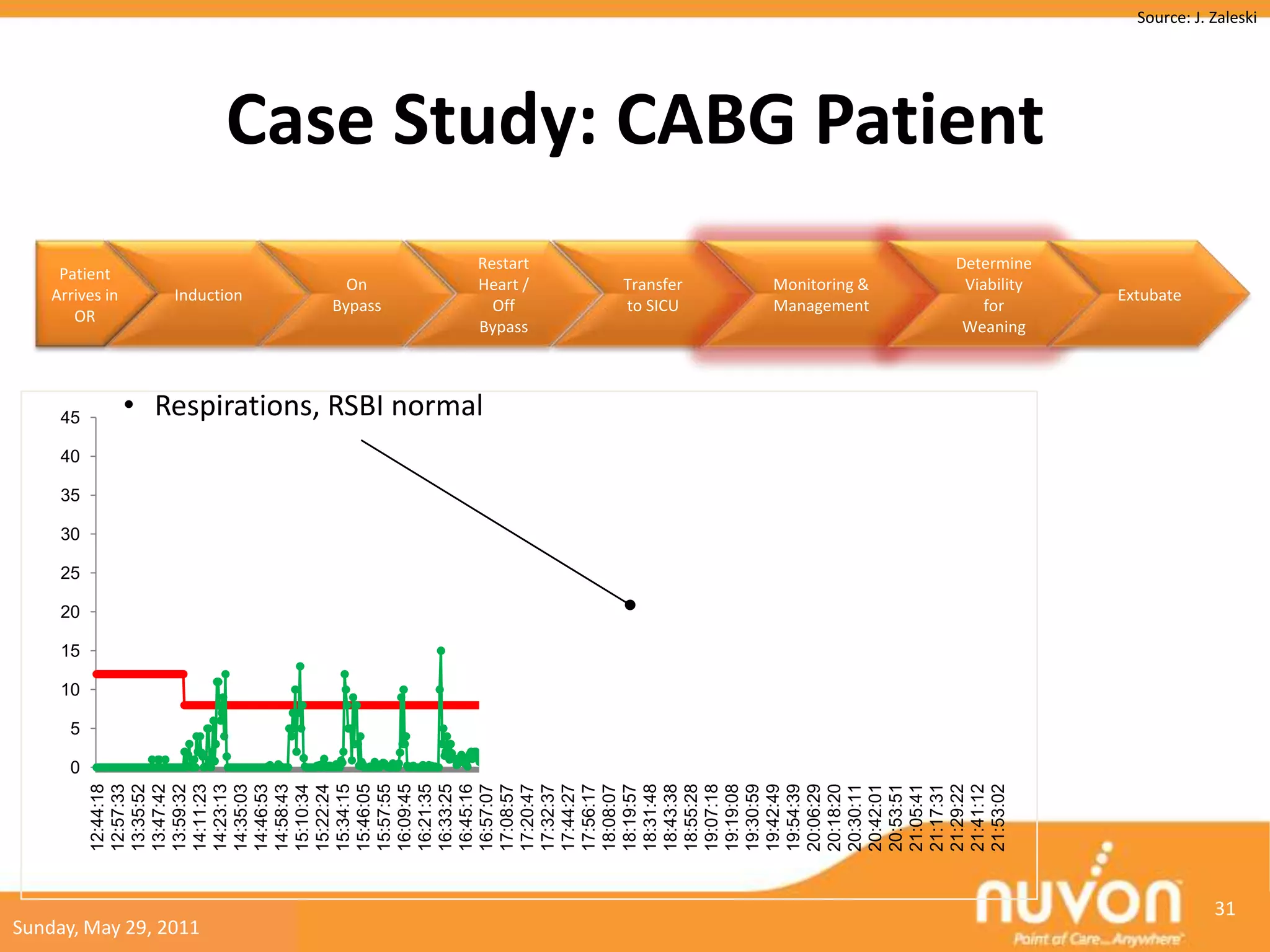 10
                                               15
                                                    20
                                                         25
                                                              30
                                                                     35
                                                                            40
                                                                                          45




                                  0
                                      5
                                                                                                                            OR
                       12:44:18




                                                                                                                          Patient
                                                                                                                         Arrives in
                       12:57:33
                       13:35:52
                       13:47:42
                       13:59:32




Sunday, May 29, 2011
                       14:11:23




                                                                   RRsp
                                                                   (/min)
                       14:23:13



                                                                                                                             Induction
                       14:35:03




                                                                             RRm (/min)
                       14:46:53
                       14:58:43
                       15:10:34
                       15:22:24
                       15:34:15
                                                                                                                            On



                       15:46:05
                                                                                                                          Bypass



                       15:57:55
                       16:09:45
                       16:21:35
                       16:33:25
                       16:45:16
                                                                                          • Respirations, RSBI normal

                       16:57:07
                                                                                                                          Off




                       17:08:57
                                                                                                                        Bypass
                                                                                                                        Heart /
                                                                                                                        Restart




                       17:20:47
                       17:32:37
                       17:44:27
                       17:56:17
                       18:08:07
                       18:19:57
                       18:31:48
                                                                                                                          to SICU




                       18:43:38
                                                                                                                          Transfer




                       18:55:28
                       19:07:18
                       19:19:08
                       19:30:59
                       19:42:49
                       19:54:39
                       20:06:29
                       20:18:20
                       20:30:11
                                                                                                                          Monitoring &
                                                                                                                          Management




                       20:42:01
                       20:53:51
                       21:05:41
                       21:17:31
                       21:29:22
                       21:41:12
                                                                                                                            for




                       21:53:02
                                                                                                                         Viability

                                                                                                                         Weaning
                                                                                                                        Determine
                                                                                                                                         Case Study: CABG Patient

                                                                                                                             Extubate




                 31
                                                                                                                                                                    Source: J. Zaleski
 