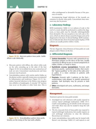 Moccasin Pattern Tinea Clinical Dermatology (Lange Medical Books).pdf