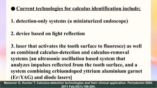 Calculus Detecting Solution Clinical diagnosis advancements in periodontics | PPTX