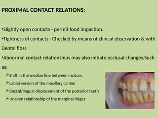 Tooth Contact Exceptions CLINICAL DIAGNOSIS in periodontal disease | PPTX