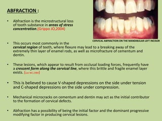 Tooth Microfracture CLINICAL DIAGNOSIS M.pptx