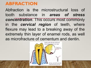 Tooth Microfracture Comprehensive Clinical Diagnosis in Periodontics: Principles and ...