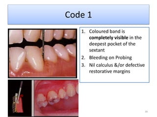 Clinical diagnosis of periodontal diseases | PPTX