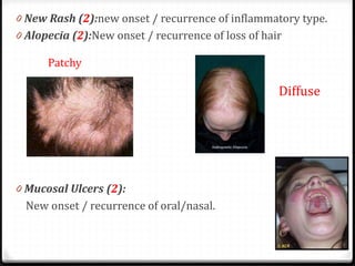 Clinical diagnosis of systemic lupus erythematosus | PDF