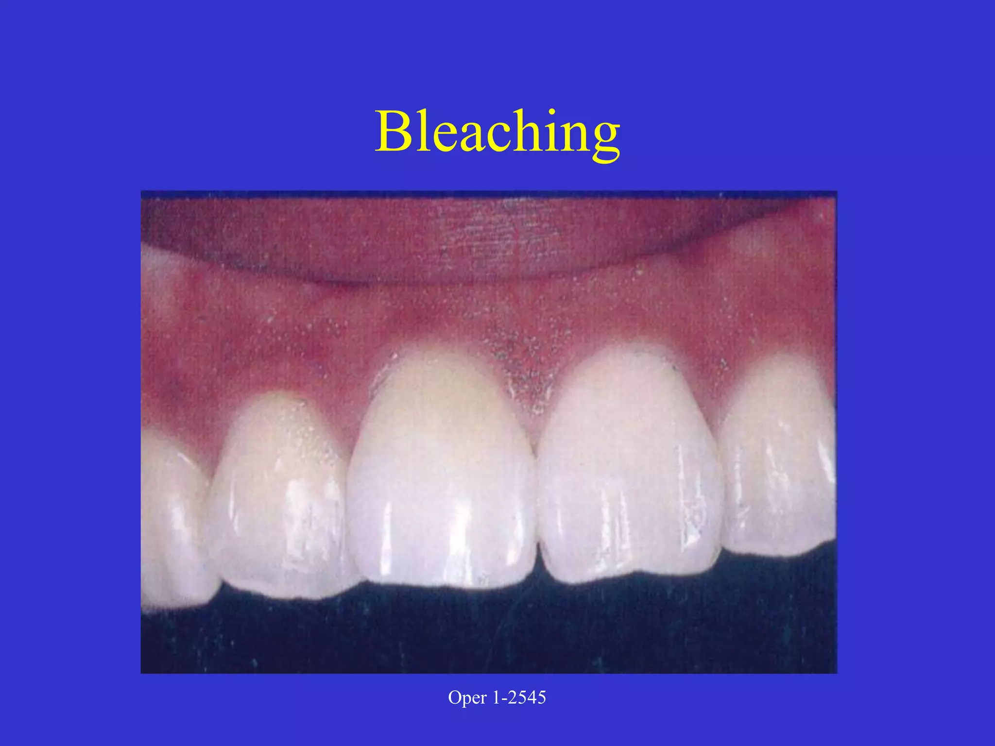 Clinical Diagnosis of Tooth Defects and Treatment Plan.ppt