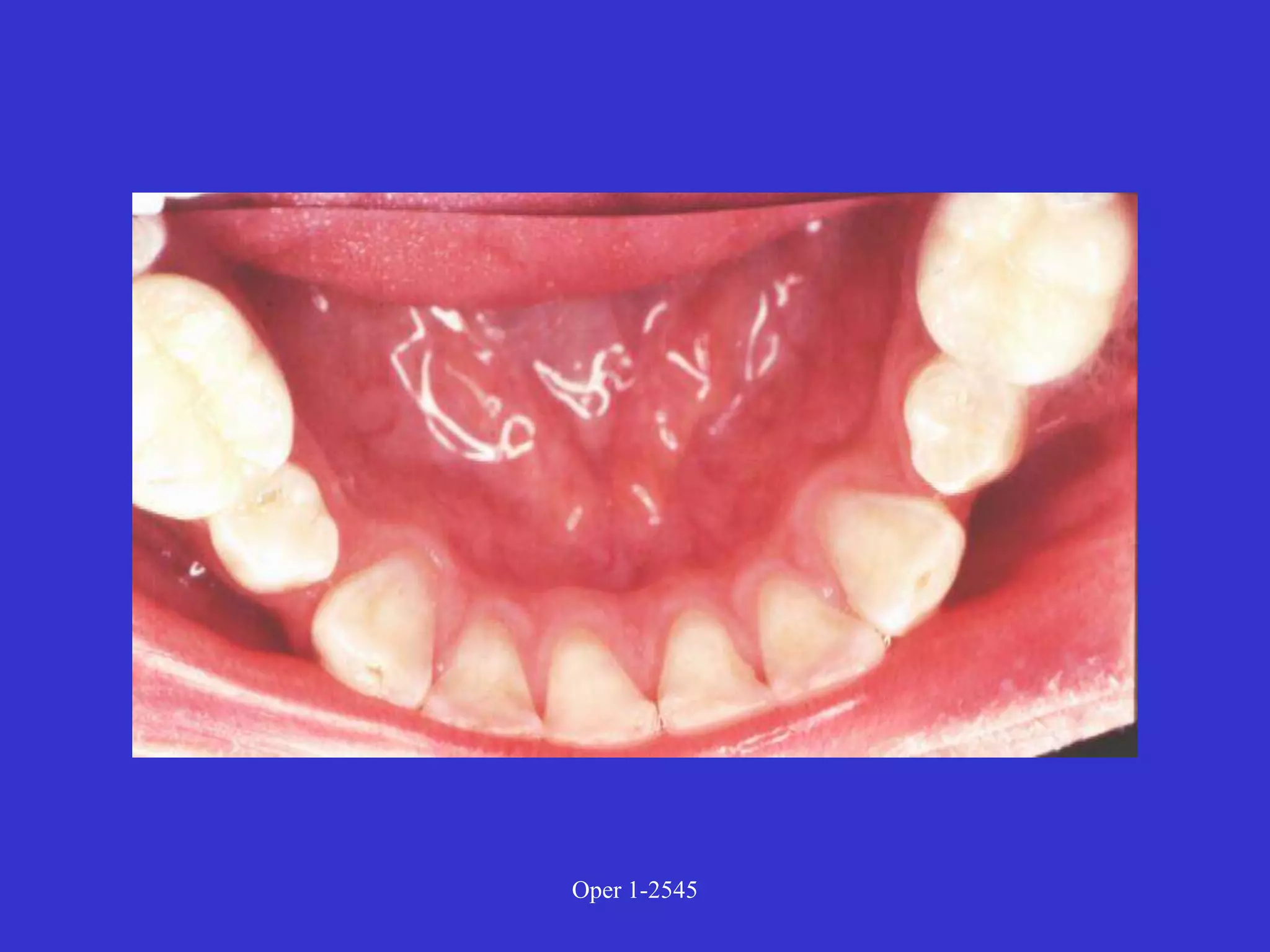 Clinical Diagnosis of Tooth Defects and Treatment Plan.ppt