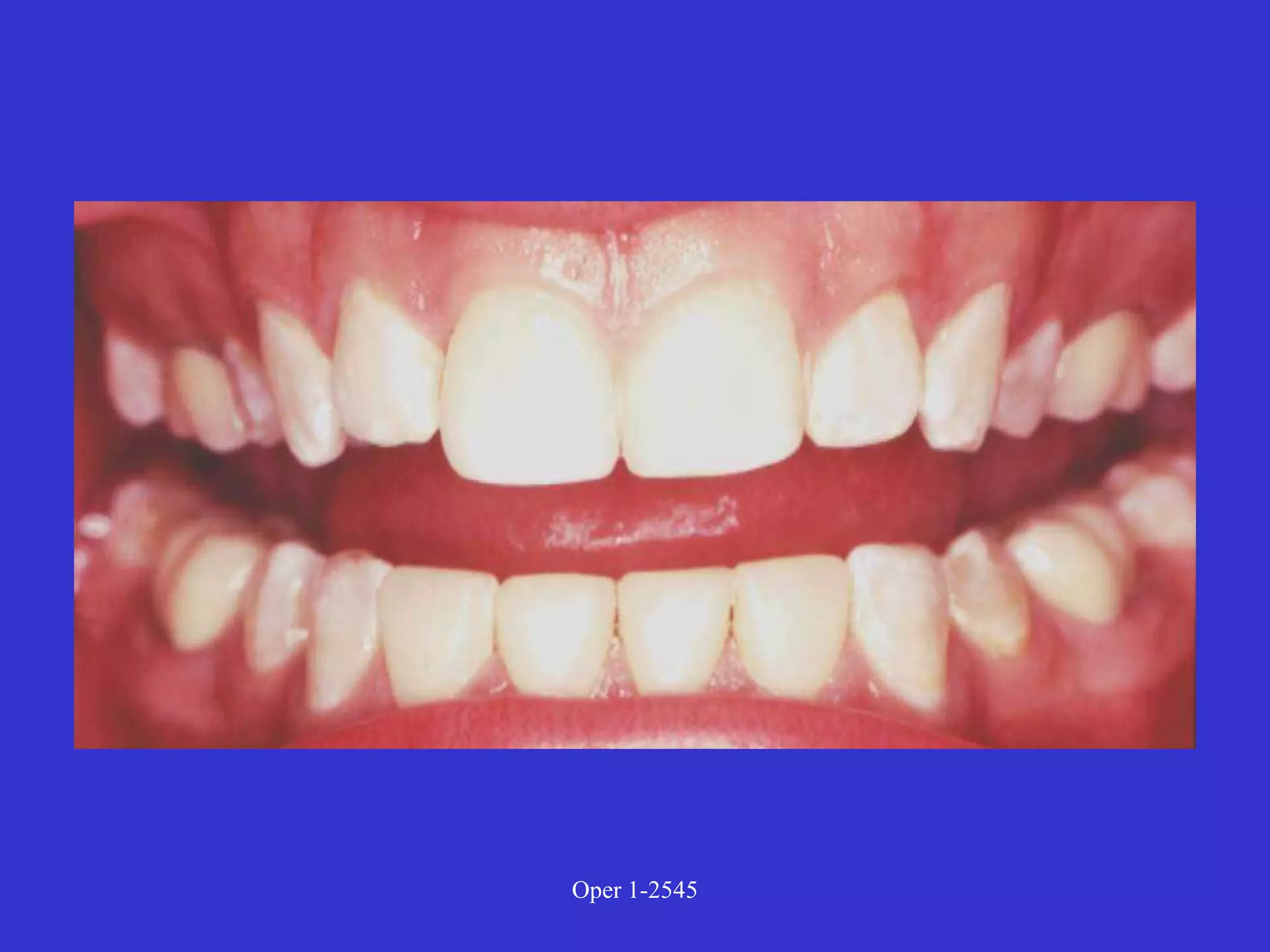 Clinical Diagnosis of Tooth Defects and Treatment Plan.ppt