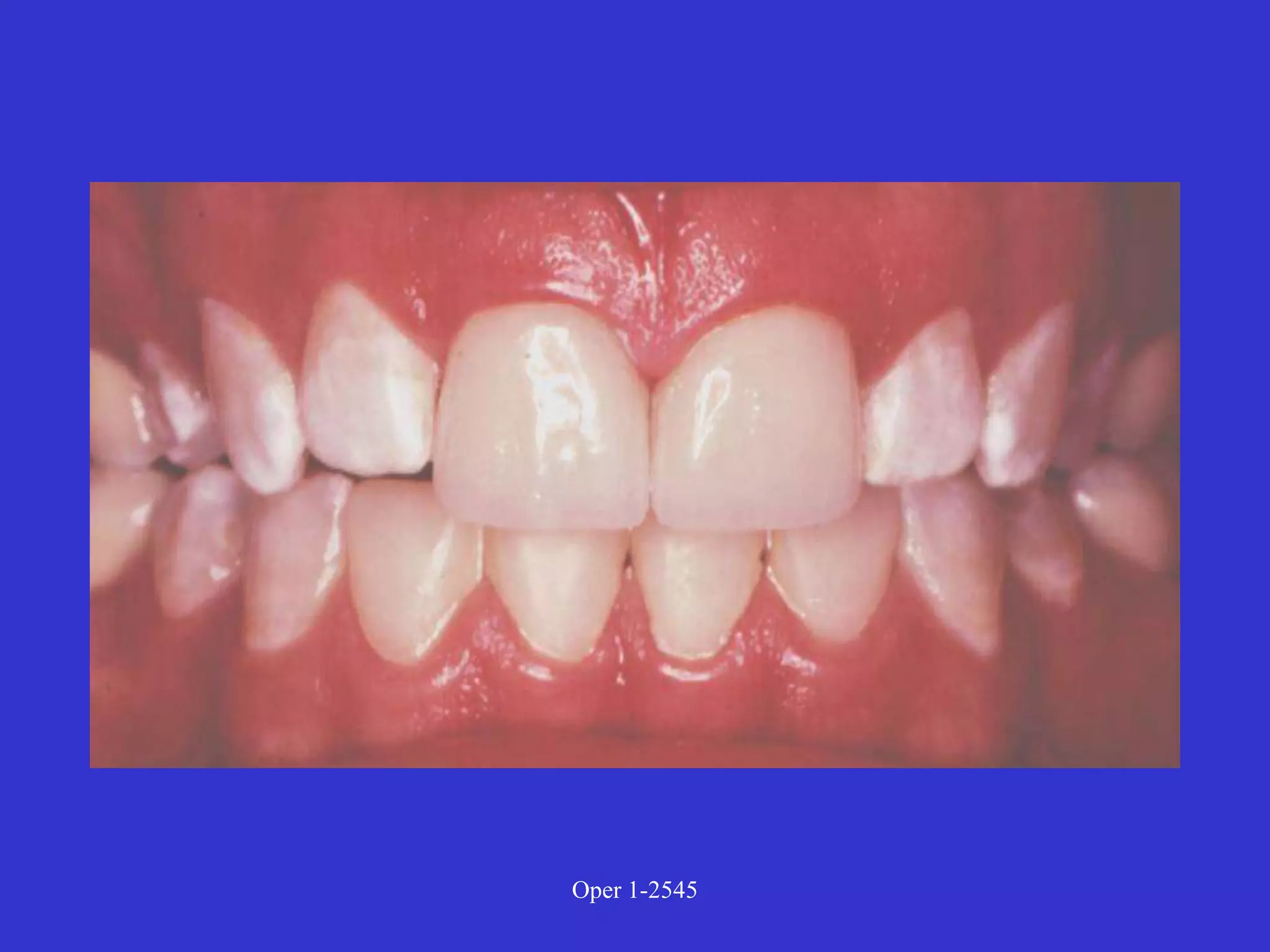 Clinical Diagnosis of Tooth Defects and Treatment Plan.ppt