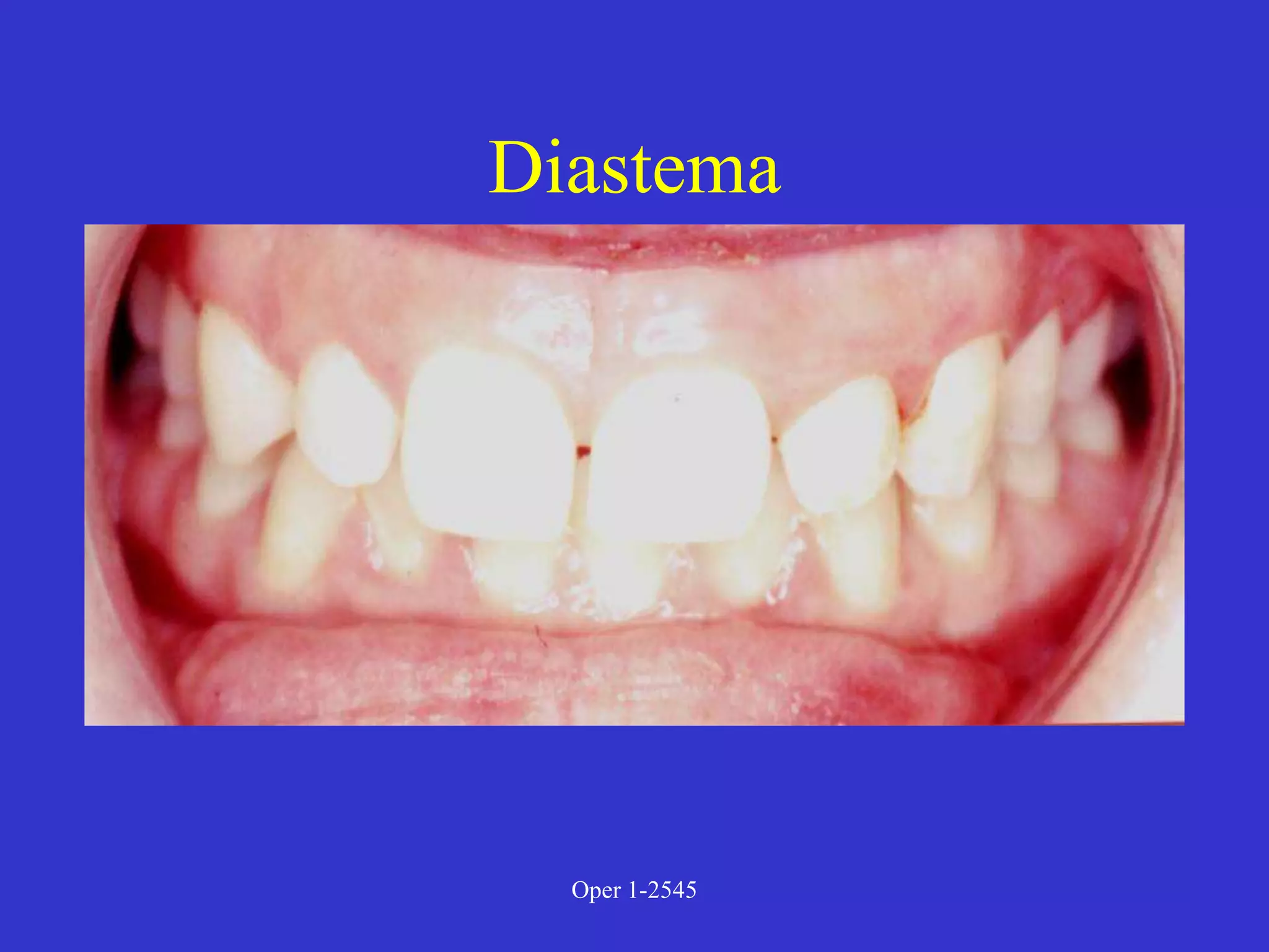 Clinical Diagnosis of Tooth Defects and Treatment Plan.ppt
