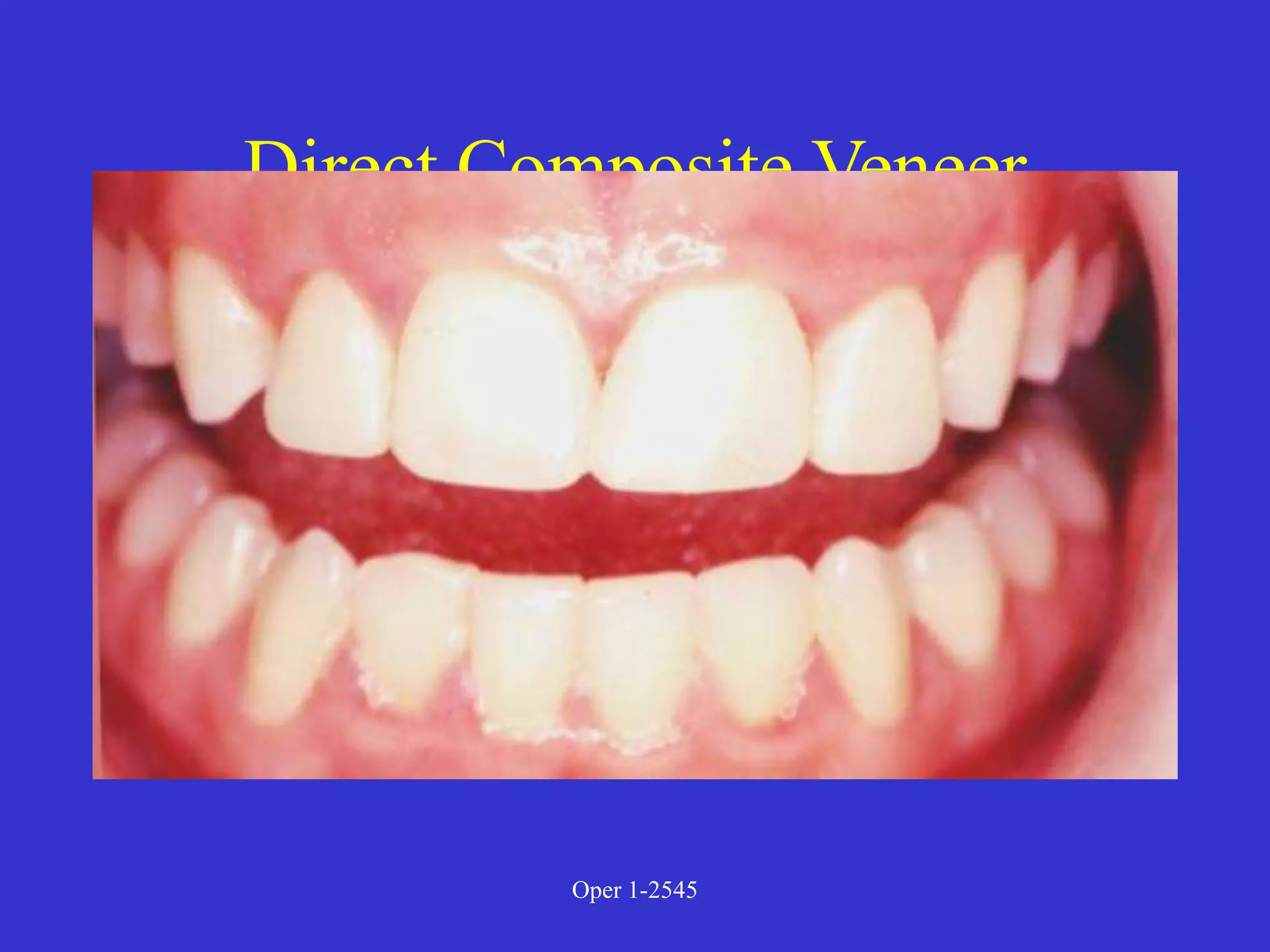 Clinical Diagnosis of Tooth Defects and Treatment Plan.ppt